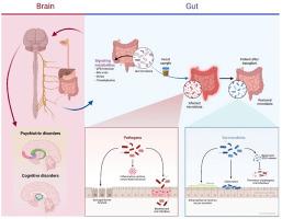 Faecal microbiota transplantation as a novel approach for autism-associated anxiety: A critical therapeutic appraisal