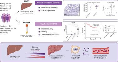 GDF15 is associated with hepatocellular senescence and correlates with mortality in patients with alcohol-associated hepatitis