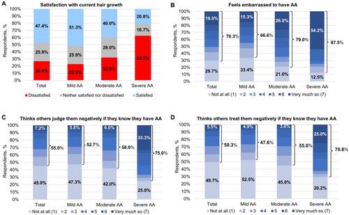 Perceived Stigma and Mental Health Disorders Among Adults With Alopecia Areata Living in Japan