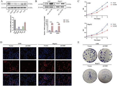 ACSM5 Regulates Ferroptosis in Hepatocellular Carcinoma by Up-Regulating POR and Modulating Lipid Metabolism