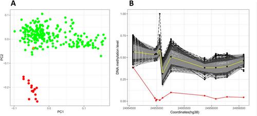 Diagnosis of Angelman Syndrome, With 66 Years of Delay, Using Hypothesis-Free DNA Methylation Profiling