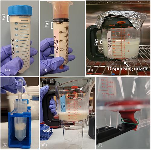 Development of home-based methods to defat human milk for infants with chylothorax: An experimental study