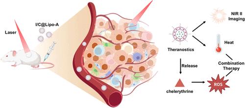 NIR-II Fluorescence Imaging-Guided Combinatorial Therapy of Breast Cancer Using ICG/Chelerythrine-Loaded Aptamer-Targeted Liposomes