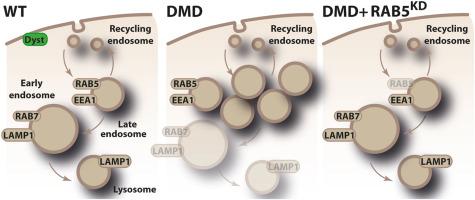 Early Endosome Disturbance and Endolysosomal Pathway Dysfunction in Duchenne Muscular Dystrophy