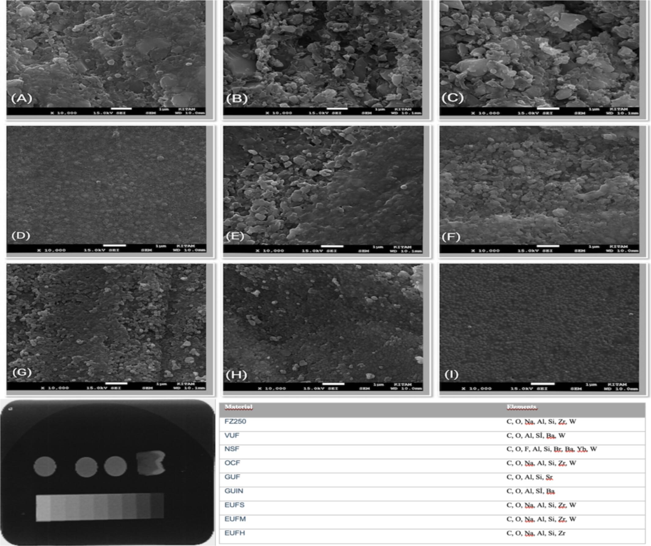 Radiopacity of Universal Flowable Composite Resins: A Comparative Evaluation
