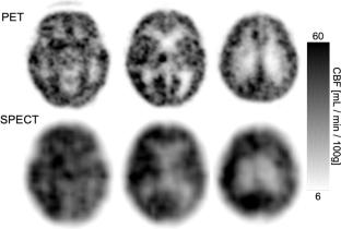 Measurement accuracy and practicality of 15O-gas PET using a high-sensitivity whole-body PET/CT scanner