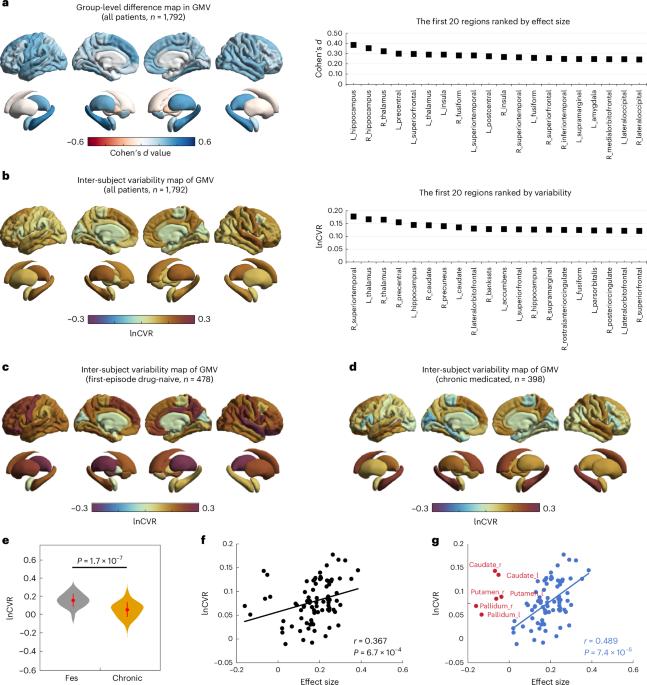 Gray matter volume heterogeneity by stage, site of origin and pathophysiology in schizophrenia