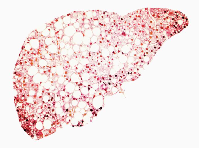 Fatty liver disease induced by maternal obesity is driven by metabolic rewiring of Kupffer cells