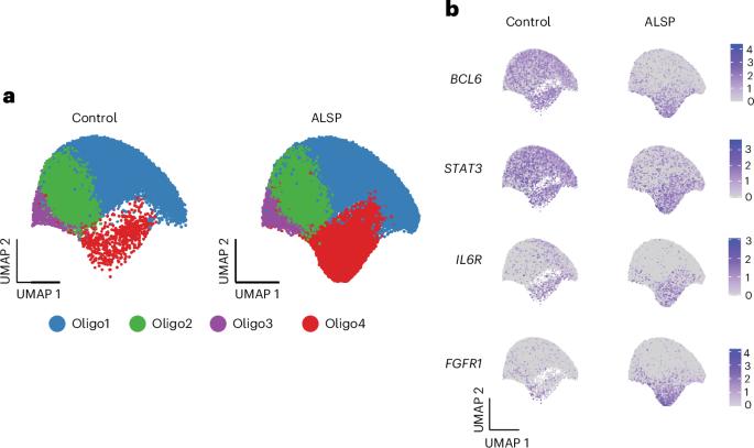 Microglia loss triggers glial stress and white matter damage in human leukodystrophy