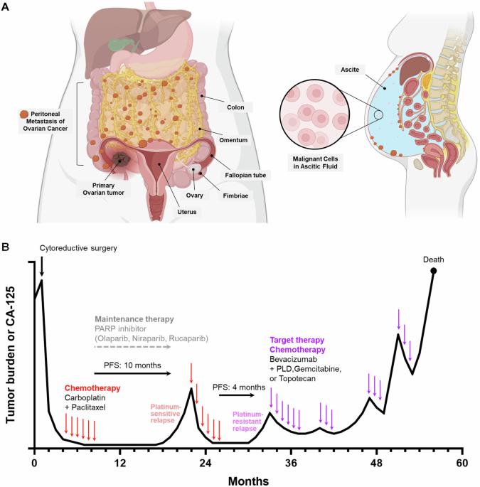 AAV for ovarian cancer gene therapy