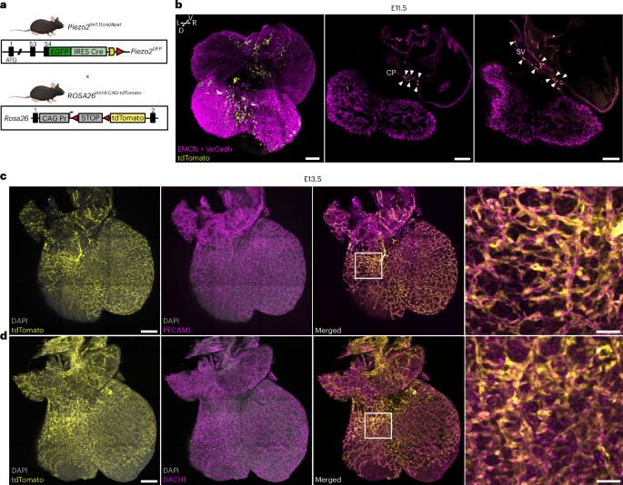 Mechanosensitive PIEZO2 channels shape coronary artery development