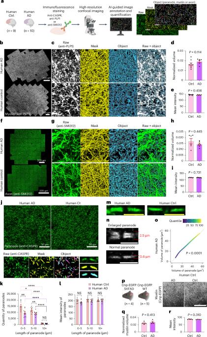 Myelin–axon interface vulnerability in Alzheimer’s disease revealed by subcellular proteomics and imaging of human and mouse brain