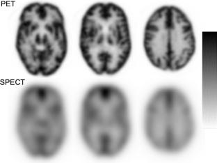 Measurement accuracy and practicality of 15O-gas PET using a high-sensitivity whole-body PET/CT scanner