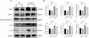 Acute high-altitude hypoxia induced NLRP3 inflammasome activation in pulmonary artery smooth muscle cells by BMAL1 targeting mitochondrial VDAC1-mediated MtDNA leakage
