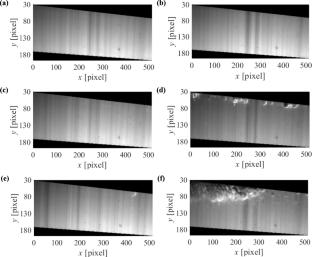 Quantitative characterization of elongated bubble breakup dynamics in intermittent flow using Stereo-PIV/PLIF