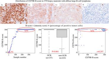 Correlation with CD79B expression and clinicopathological parameters including cell of origin, CD79A and CD19 expression, and CD79B mutation in diffuse large B-cell lymphoma