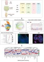 Single-cell and spatial transcriptome profiling identifies cellular heterogeneity and immunosuppressive tumor microenvironment in inflammatory breast cancer
