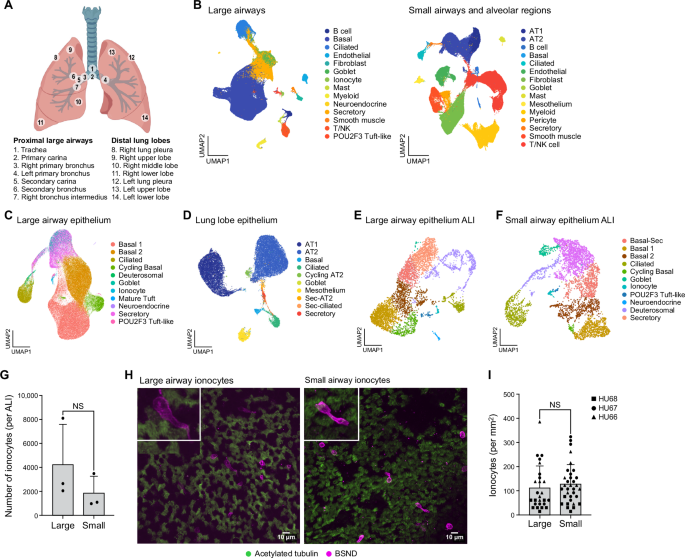 Single cell profiling of human airway identifies tuft-ionocyte progenitor cells displaying cytokine-dependent differentiation bias in vitro