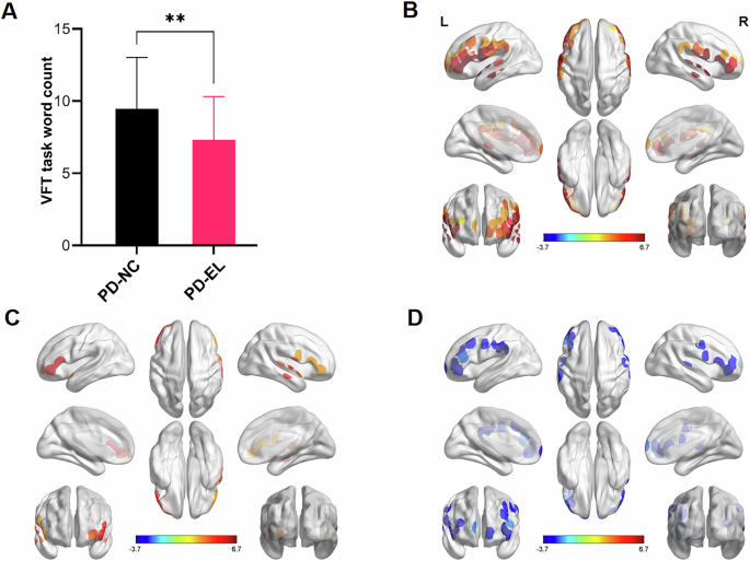 Neural basis of dysexecutive and visuospatial impairments in Parkinson’s disease with MCI: a task-based fNIRS study