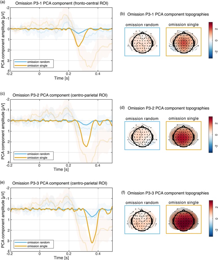 Auditory N1 Suppression and Omission N1 Do Not Share a Common Underlying Mechanism.