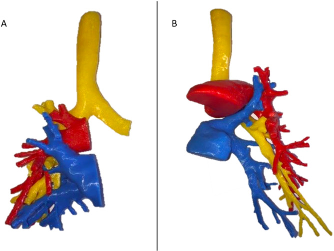 Contribution of 3D visualization and printing in teaching lung segments anatomy.