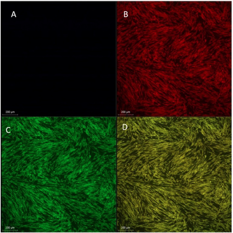 Innovative Hydroxyapatite-Coated Titania Nanotubes for Dental Implant Surface Enhancement.