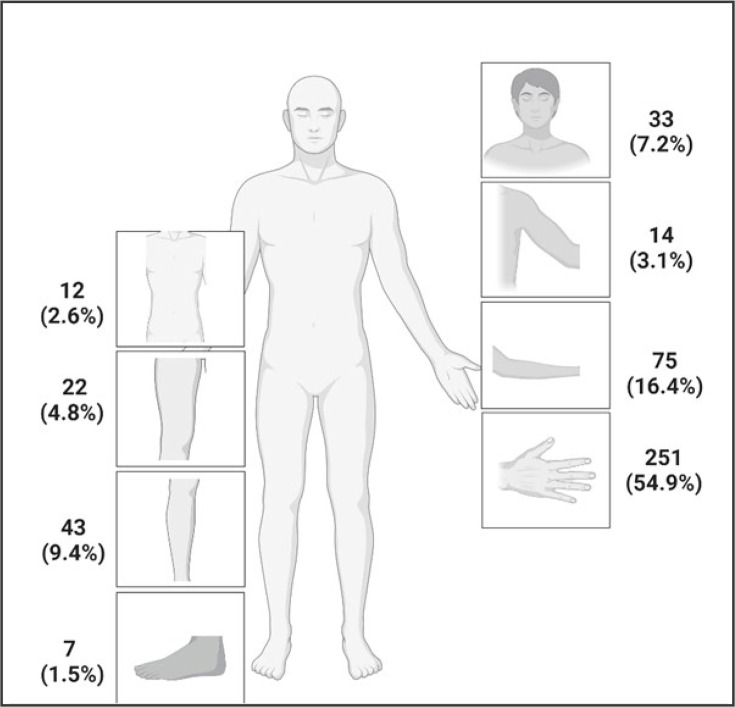 Bite injuries at a level 1 trauma center in Germany.