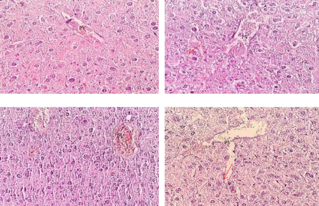 Experimental Evaluation of Dose-Dependent Hepatorenal Toxicity of Traditionally Prepared Arak in Swiss Albino Mice.