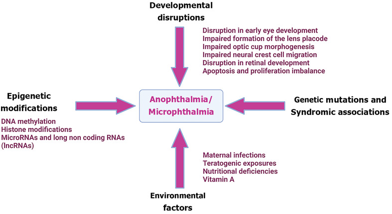 Genetic and environmental factors contributing to anophthalmia and microphthalmia: Current understanding and future directions.
