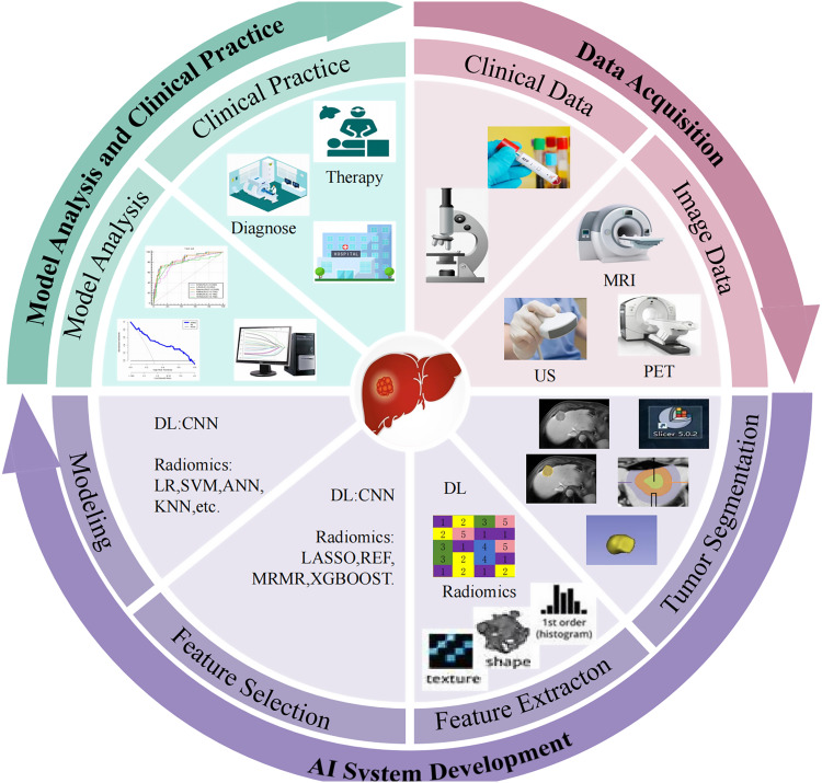 Radiomics and Deep Learning as Important Techniques of Artificial Intelligence - Diagnosing Perspectives in Cytokeratin 19 Positive Hepatocellular Carcinoma.