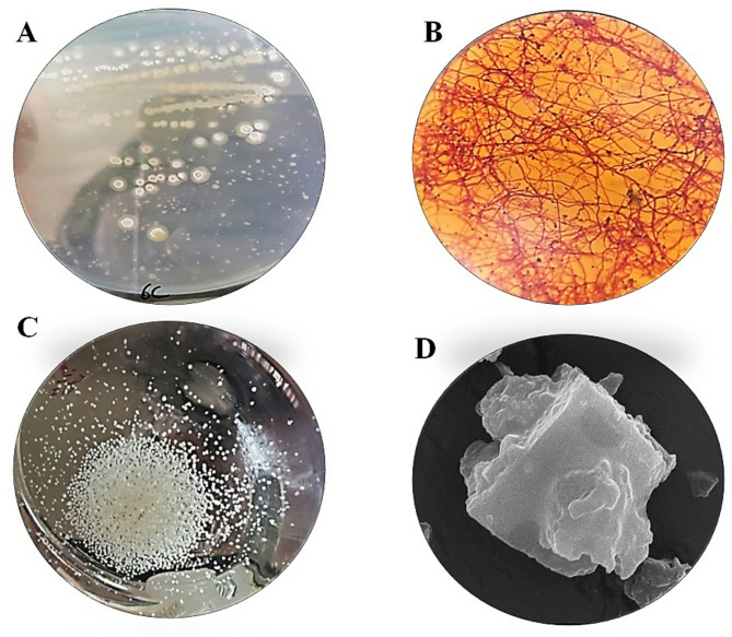 Exploring the mechanisms and mode of action of bioactive compounds from marine Streptomyces albidoflavus against breast carcinoma cells.