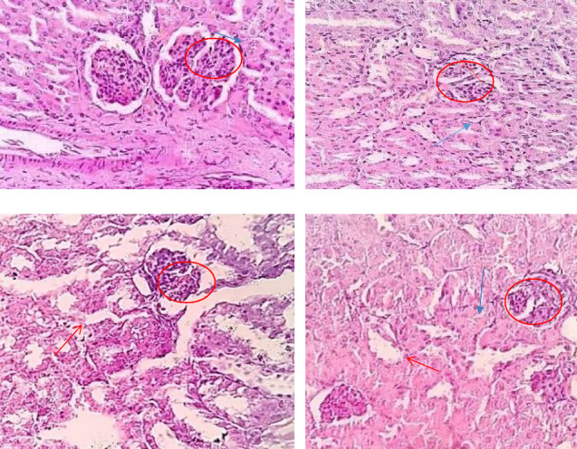 Experimental Evaluation of Dose-Dependent Hepatorenal Toxicity of Traditionally Prepared Arak in Swiss Albino Mice.