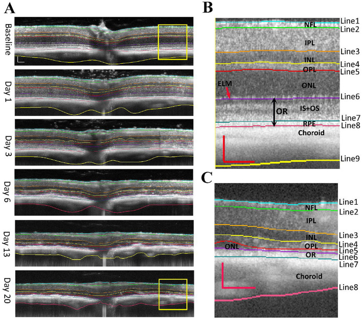 Evaluation of retinal structure changes with AI-based OCT image segmentation for sodium iodate induced retinal degeneration.