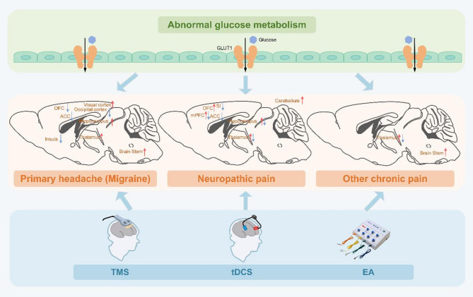 The relationship between abnormal glucose metabolism and chronic pain.