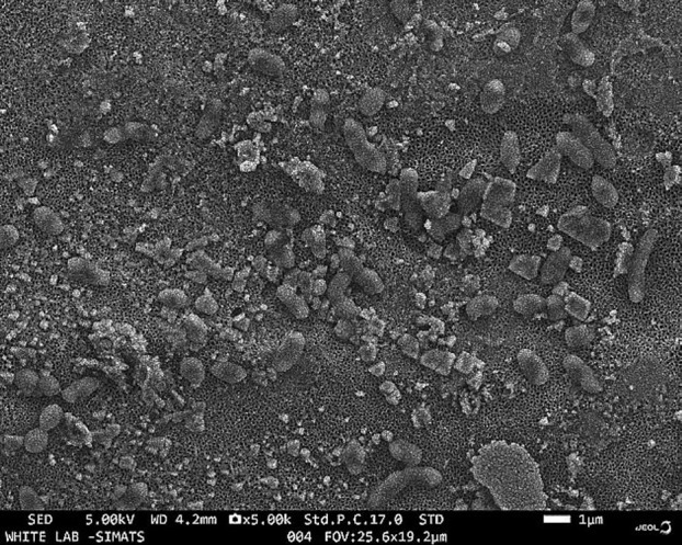Innovative Hydroxyapatite-Coated Titania Nanotubes for Dental Implant Surface Enhancement.