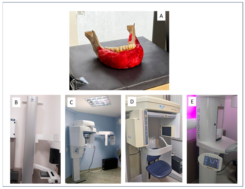 Voxel Size and Field of View Influence on Periodontal Bone Assessment Using Four CBCT Systems: An Experimental Ex Vivo Analysis.