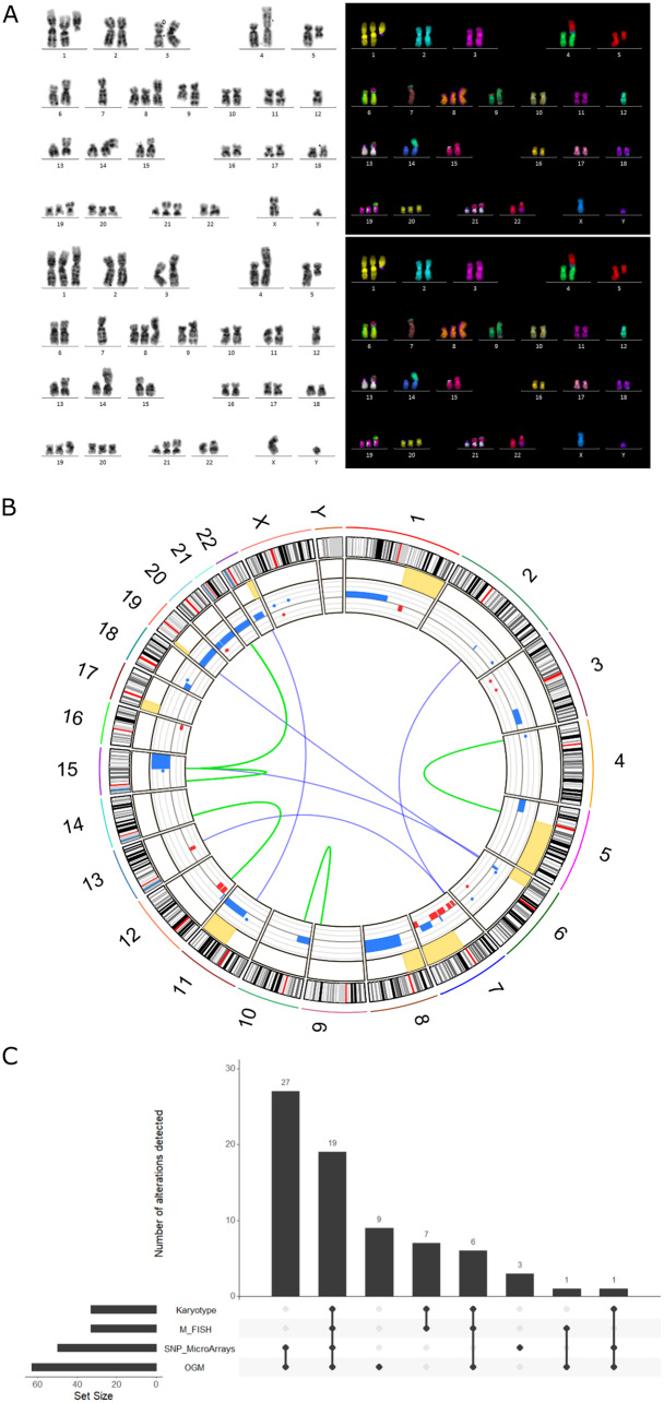 Integrated cytogenetic and genomic profiling of the MDS-L cell line.