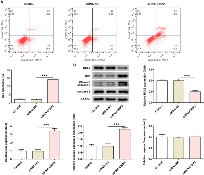 CtBP2 Regulates Wnt Signal Through EGR1 to Influence the Proliferation and Apoptosis of DLBCL Cells.