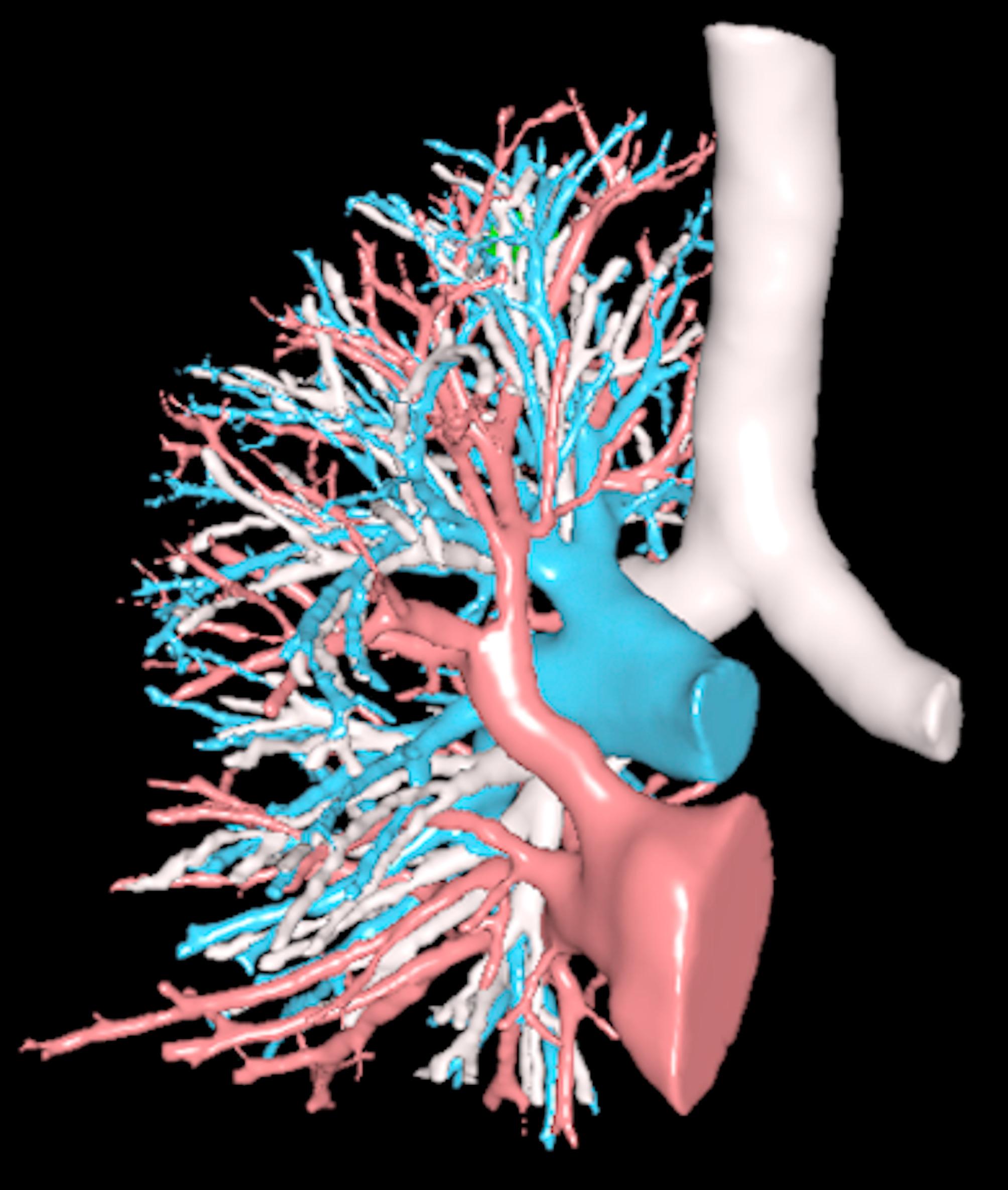 Contribution of 3D visualization and printing in teaching lung segments anatomy.