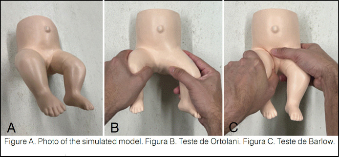 IMPACT OF PEDIATRICIAN TRAINING ON DIAGNOSIS OF DEVELOPMENTAL HIP DYSPLASIA.