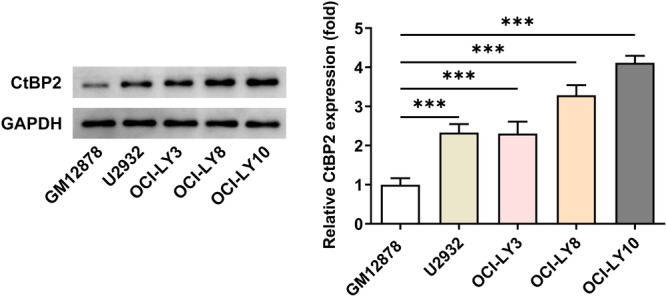 CtBP2 Regulates Wnt Signal Through EGR1 to Influence the Proliferation and Apoptosis of DLBCL Cells.