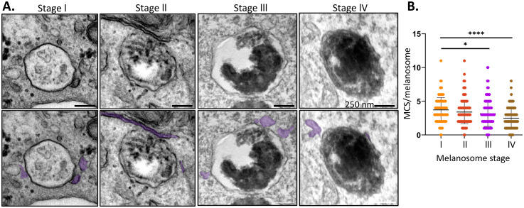 Identification of ER:Melanosome Membrane Contact Sites in the Retinal Pigment Epithelium.