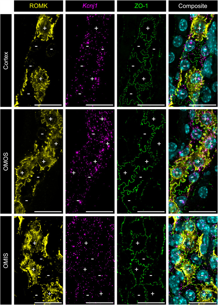 Characterization of ROMK cellular heterogeneity along the mouse kidney thick ascending limb.