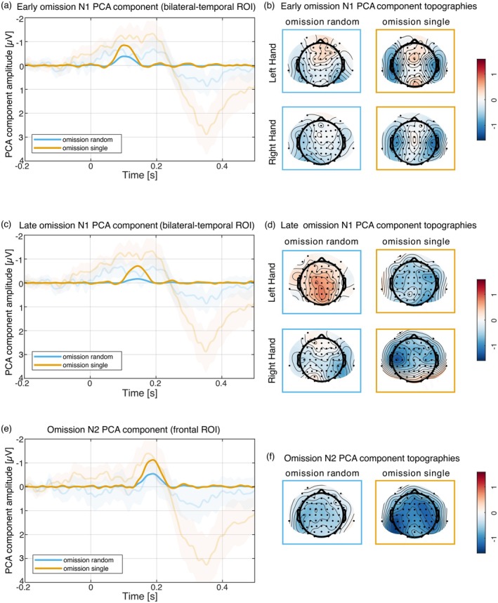 Auditory N1 Suppression and Omission N1 Do Not Share a Common Underlying Mechanism.
