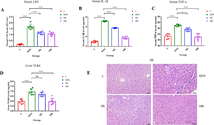 The effects of rifaximin and lactulose on the gut-liver-brain axis in rats with minimal hepatic encephalopathy.