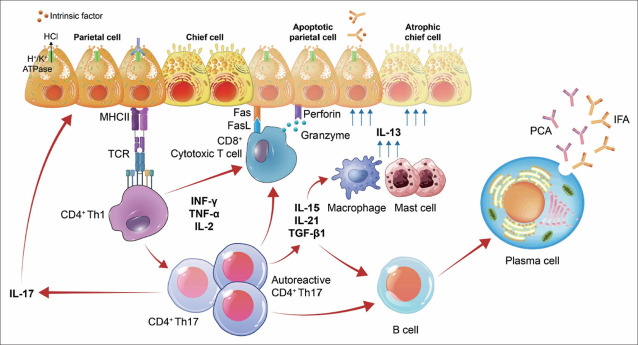 Autoimmune Gastritis: Unveiling the Mystery.