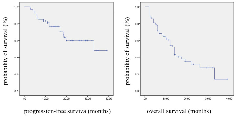 Evaluation of the Effectiveness and Safety Profile of First-Line Immune Checkpoint Inhibitors Combined with Chemotherapy in Pulmonary Sarcomatoid Carcinoma.