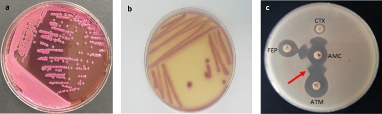 Antimicrobial resistance and molecular detection of extended-spectrum ß-lactamase (ESBL)-producing Escherichia coli in municipal wastewater in Marrakech.