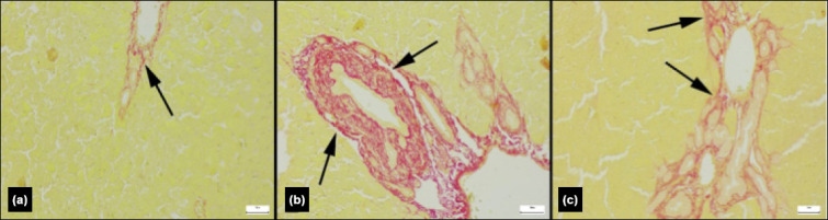 The effects of rose oil on liver damage in an experimental model of obstructive jaundice.