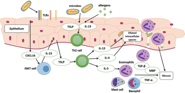 Eosinophilic Esophagitis: Emerging Insights Into Diagnosis and Management.